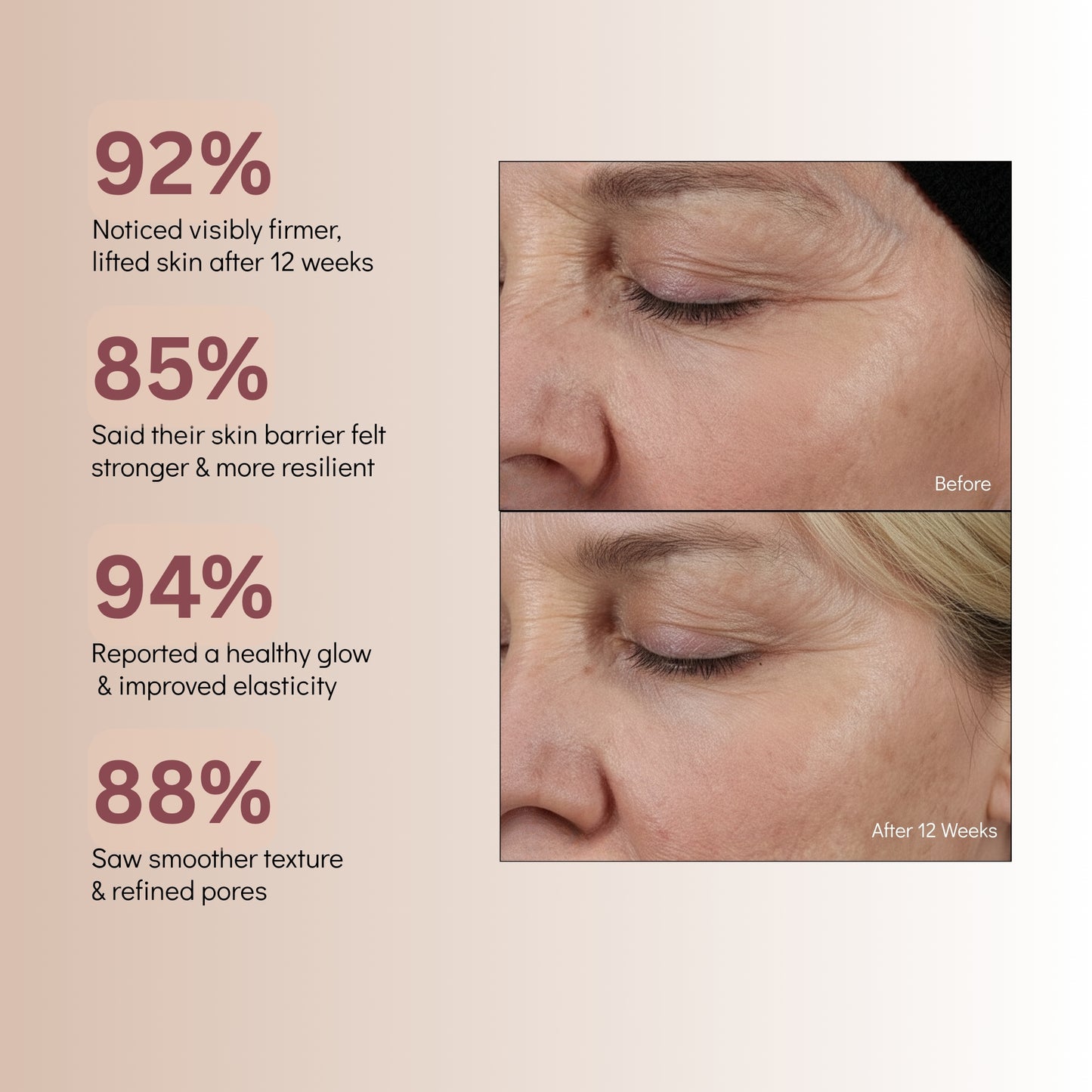 Needle-Less Growth Factor Serum